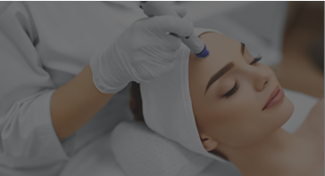 FACE THERAPY (FACIAL MICRONEEDLING)